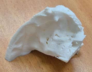 3D printed temporal bone training model