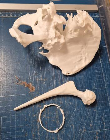 3D printed pelvis and femur for surgical planning