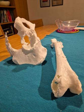 Patient-specific hip replacement planning model