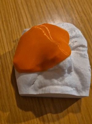 Custom bolus fitted on head cast