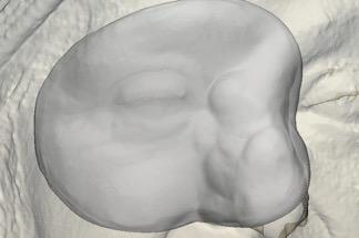 White 3D printed facial bolus