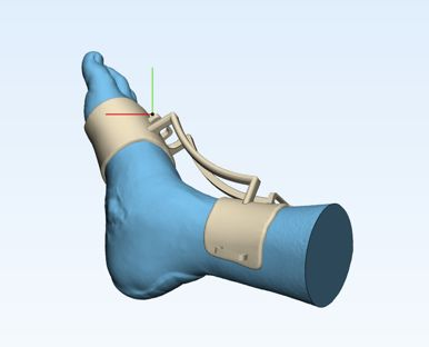 Custom rehabilitation splint