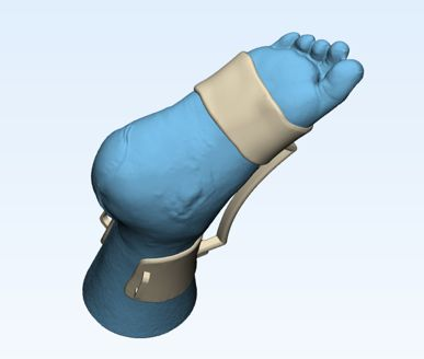 Patient-specific orthotic device