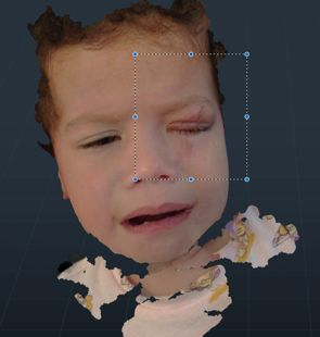 3D scan of child's face in mesh editor