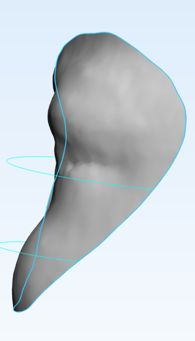 CAD design of cranial protective device