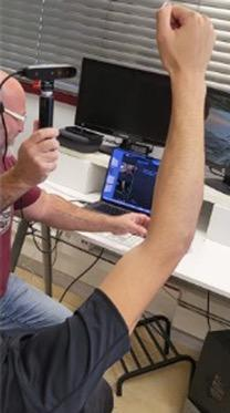 3D scanning arm for splint design