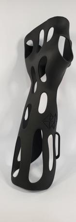 Custom full arm splint
