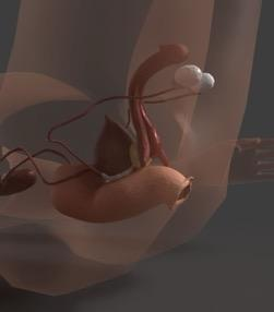 3D rendering of pelvic anatomy