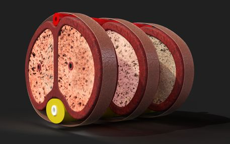 3D rendered kidney cross-sections